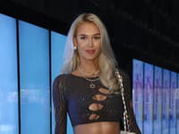 Známa Slovenka púta pozornosť aj v zahraničí: Dokonalá postava a NADUPANÝ dekolt!
