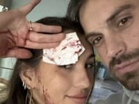 Adam a Jasmin sa počas tréningu zranili