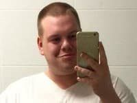 Muž (31) minul 42-tisíc na estetické zákroky: Chcem vyzerať ako filter na Instagrame! Dnes by ste ho nespoznali