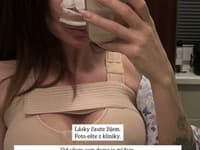 Kristi Dali podstúpila dve plastiky