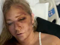 Záhadná nehoda ženy, vďaka ktorej sa prevalil sexuálny škandál Epsteina: Vpálil do nej autobus, štyri dni života!