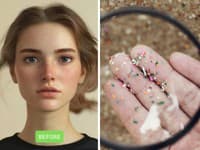 Desivé FOTO odhaľujú, čo môžu mikroplasty urobiť s vaším telom: Priberanie a riedke vlasy sú najmenší problém!
