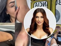 Miška z Ruže obeťou SUROVÉHO ÚTOKU: Žena ju napadla od chrbta... Ľudia volali POLÍCIU a SANITKU!