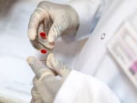 Hygienici predpokladajú v Prešovskom kraji  postupné znižovanie chorobnosti na vírusovú hepatitídu typu A
