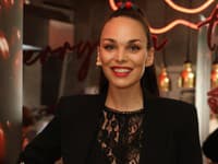 Modelka Soňa Štefková podstúpila esteticky zákrok: Sama seba som sa zľakla!