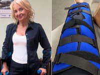 Žilkovej VÁŽNY úraz: Skončila o barlách... Zranila sa bizarným spôsobom!