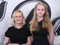 Michaela Čobejová podľahla estetickým zákrokom: Čo radí dcére? Fíha, jej slová mamy pochopia