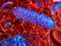 Záhadná smrť po výlete v Tatrách: Ženu zabila zákerná baktéria! Hygienici odhalili nebezpečný zdroj nákazy