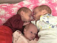 Mimoriadna udalosť v Košiciach: Narodili sa jednovaječné trojčatá, lekári hovoria o unikáte!