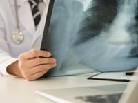 Poplach v Bojniciach: Nemocnica sa zápĺňa, majú už 11 pacientov s vážnou diagnózou! NIKTO nepozná pôvod choroby