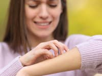 TOTO po uštipnutí hmyzom NIKDY neignorujte! Následky môžu byť katastrofálne, rozhodujú sekundy