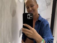 Zuzana Belohorcová si nechala odstrániť silikónové implantáty.