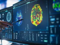 Bojíte sa, že trpíte Alzheimerom? PRELOMOVÉ zistenie britských vedcov: Nový test odhalí prvé príznaky za tri minúty