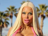 Žena chce byť živá Barbie: Na svoju premenu minula vyše 250-tisíc eur! Jej staré FOTO šokujú internet