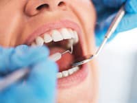 TOTO vám zubár nepovie: V osmičkách sú bunky, ktoré dokážu regenerovať celé orgány! Nevyhadzujte ich