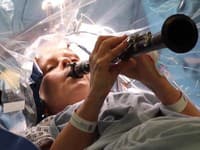 Neuveriteľný moment z operačnej sály: Žena hrala na klarinet s otvorenou lebkou! Lekári hovoria o ZÁZRAKU