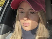 Majka Glatzová po fyzickom útoku susedky.