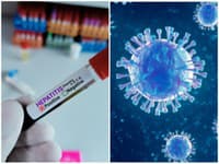 Hygienici evidujú v Trnavskom kraji trojnásobný medziročný nárast žltačky typu A