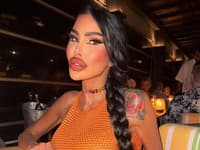 Živá Barbie opäť šokuje: Ukázala FOTKY spred zákrokov! Do plastík naliala vyše 100-tisíc eur, v Austrálii dostala STOPKU