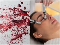 Nový ŠIALENÝ trend na TikToku: Ženy si natierajú tvár MENŠTRUAČNOU krvou! Čo na to dermatológovia?