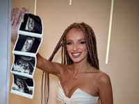 Nečakané prekvapenie: Slovenská speváčka je TEHOTNÁ... Prvé FOTO s bruškom