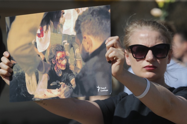 Na snímke žena drží fotografiu protestujúceho, ktorého zbila polícia počas zhromaždenia 15. augusta 2020 v Minsku.