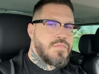 Ďalší slovenský raper odhalil DESIVÚ DIAGNÓZU: Nádor na mozgu!