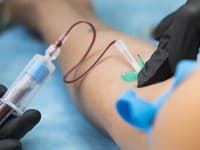 Vedci skúmali biologický vek: Prekvapilo ich, čo NAŠLI v krvi! Telo môže starnúť POMALŠIE než ukazuje kalendár