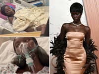 TAJNÝ BOJ slávnej supermodelky: Vrodená chyba pľúc... Musela podstúpiť DESIVÚ OPERÁCIU!