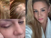 Aféra, akú šoubiznis nezažil: Už padli TRESTY... Známa kráska bola počas napadnutia TEHOTNÁ!