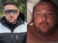 Český herec schudol takmer 130 kíl a teraz: Ide na 3 OPERÁCIE... Trápi ho OBROVSKÝ prebytok kože!