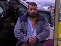 Vémolovi fixuje čeľusť kovová dlaha.