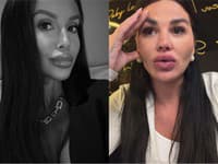 Plačková naložila verejnosti kvôli SMRTI Jákliovej (†31): Vám už vážne d*be? TOTO je cez čiaru!