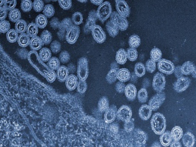 Vírus H5N1