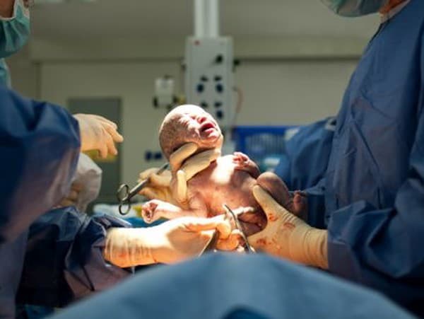 Rodičia aj lekári zostali pri pohľade na novorodeniatko v šoku: Pozrite, čo má na rukách aj nohách