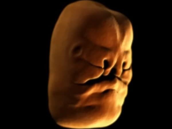 VIDEO ukazuje, ako sa v tehotenstve vyvíja tvár plodu: Ľudia sú v šoku, poriadne ich vydesilo