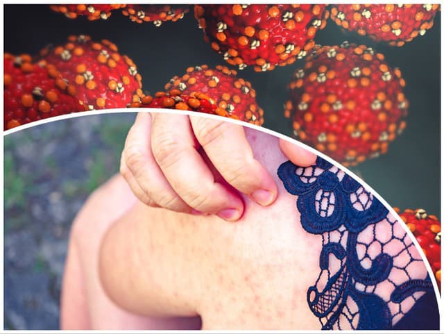 Európou si šíri vysoko