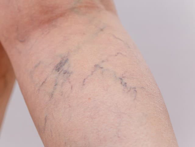 Tieto potraviny zaraďte do