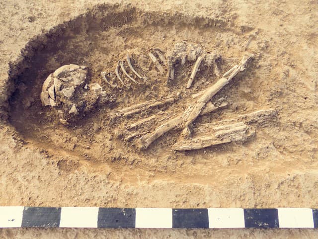 Zabudnite na biely úsmev: