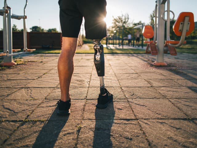 Sledovala, ako jej NOHA