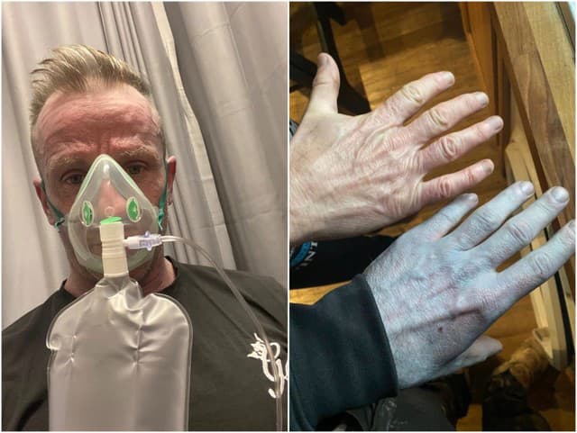 Jeho pokožka zmodrala a