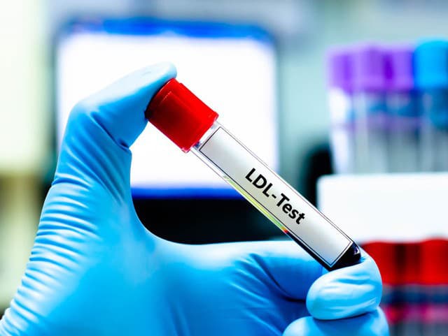 Prečo sa cholesterol zhoršuje