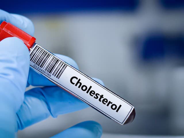 Skrytý cholesterol môže až