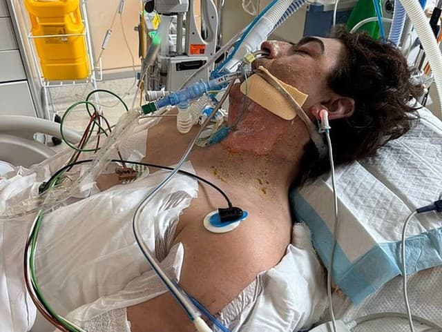 Upratovanie sa takmer skončilo smrťou: Mužovi explodoval robotický vysávač! Utrpel strašné popáleniny
