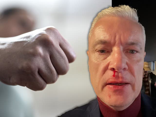 Dobitý Ferenčák na ulici: Prvýkrát prehovoril ÚTOČNÍK Stano, politik mal pred útokom napomenúť hlučnú partiu!