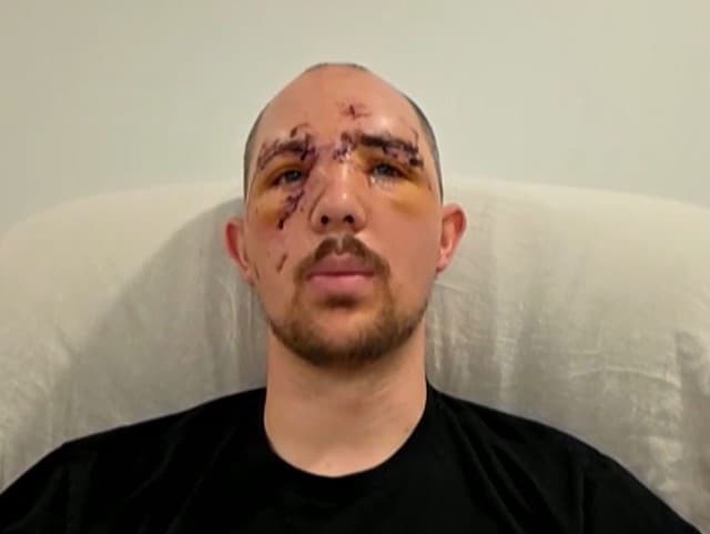 Jadon Nicoara prežil útok