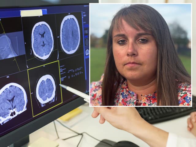 ŠOKUJÚCI omyl v nemocnici! Po 11 rokoch a 156 cykloch CHEMOTERAPIE zistila, že rakovinu mozgu NIKDY nemala