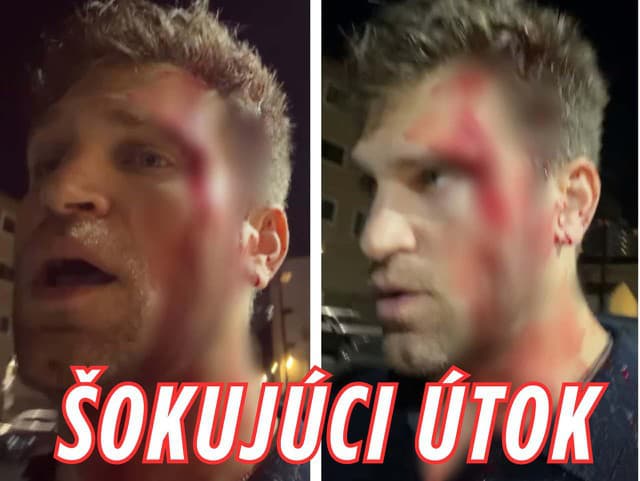 Známeho herca prepadli ozbrojení