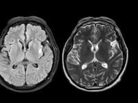 Vaša pamäť KLAME: Vedci odhalili, ako si náš mozog PREPISUJE minulosť, aby sme vyzerali úspešnejšie!