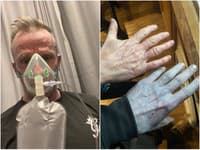 Zobudil sa MODRÝ od hlavy po päty: Lekári ho OKAMŽITE ratovali! Keď prišli na príčinu, nevedeli sa prestať SMIAŤ